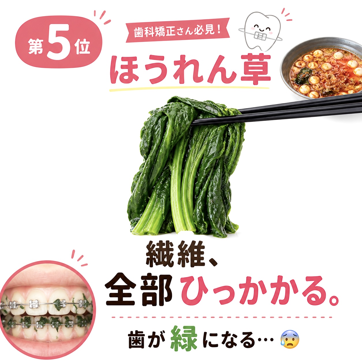 歯科矯正で引っかかる具材 第5位 ほうれん草